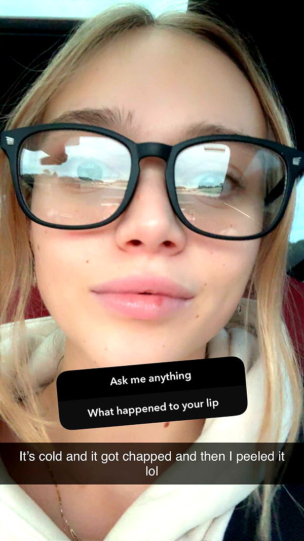 kydoddss image ~ Altpins