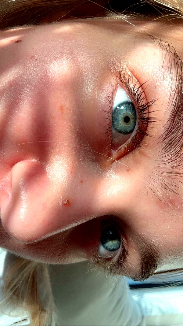 kydoddss image ~ Altpins