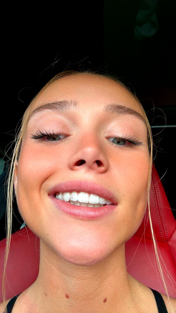 kydoddss image ~ Altpins