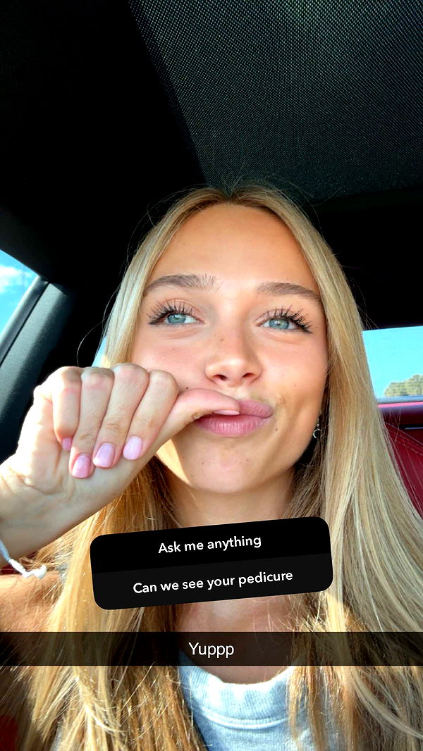 kydoddss image ~ Altpins