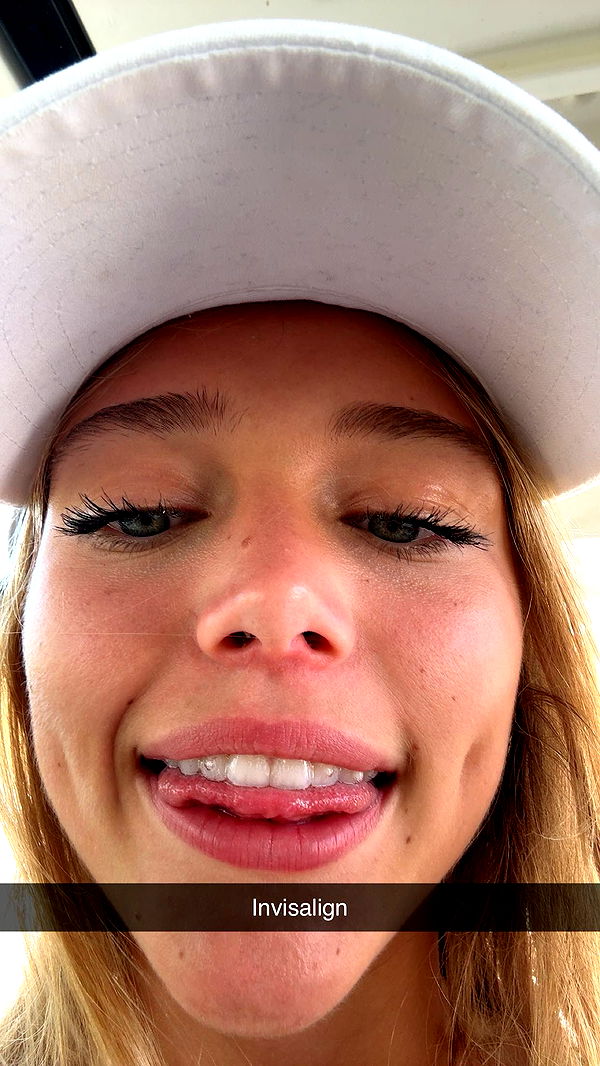 kydoddss image ~ Altpins