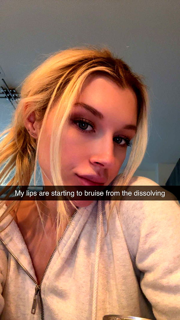 kylaayese image ~ Altpins