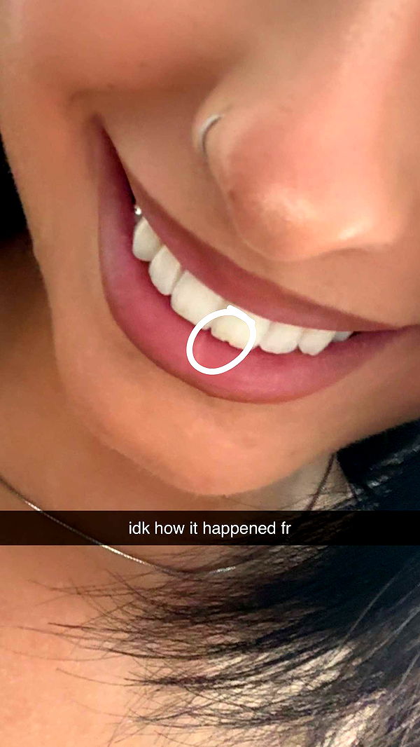 lew12001 image ~ Altpins