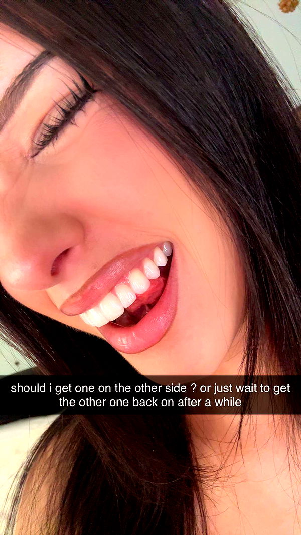 lew12001 image ~ Altpins