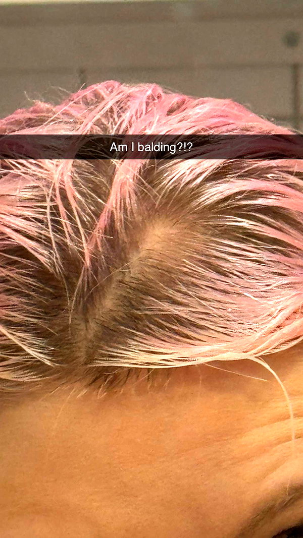 linzoor snapchat image archive image