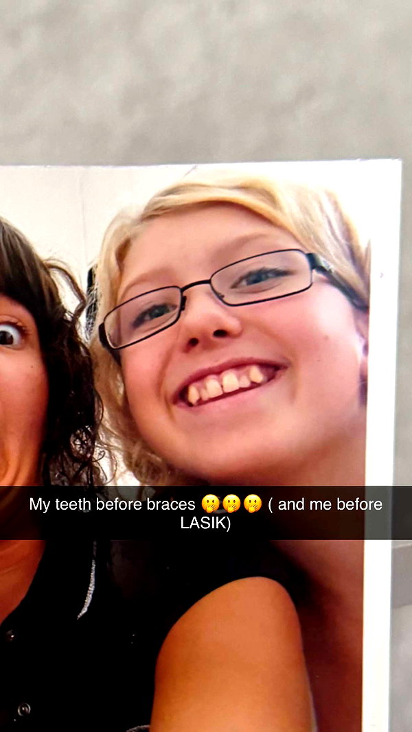 linzoor snapchat image archive image
