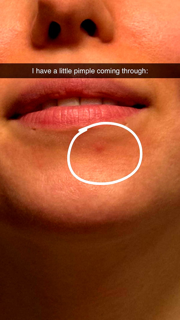 linzoor snapchat image archive image