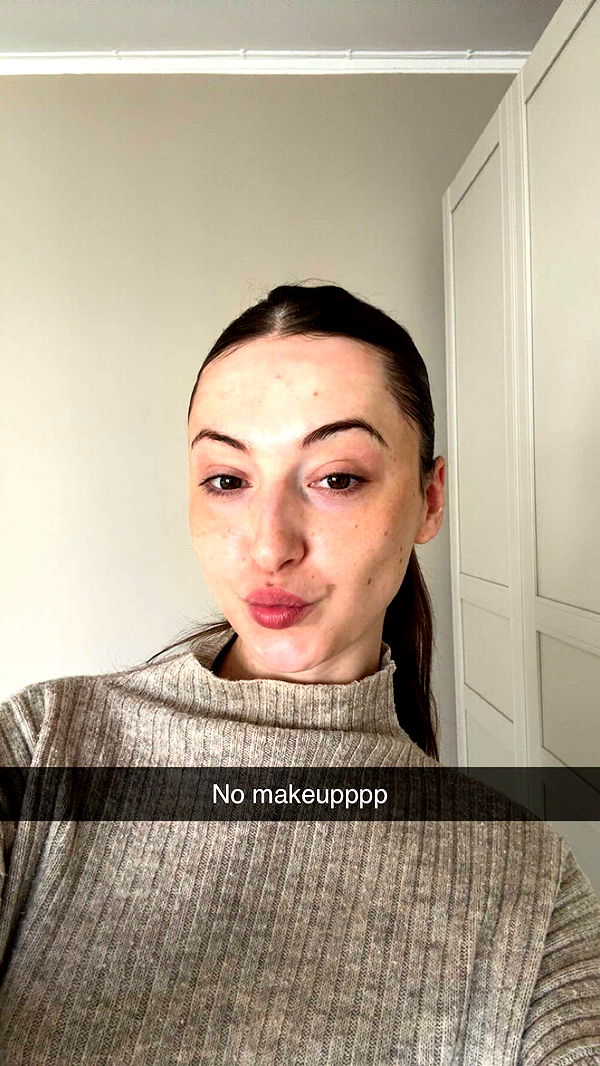 mathilda_bergs image ~ Altpins