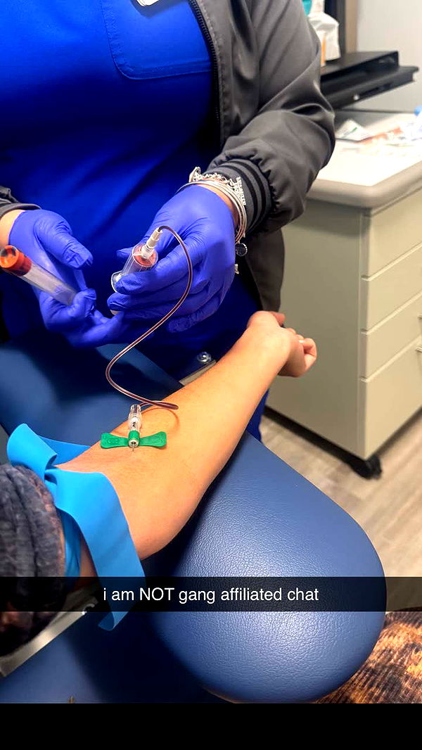 mbeeco image ~ Altpins