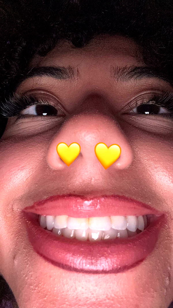 mbeeco image ~ Altpins