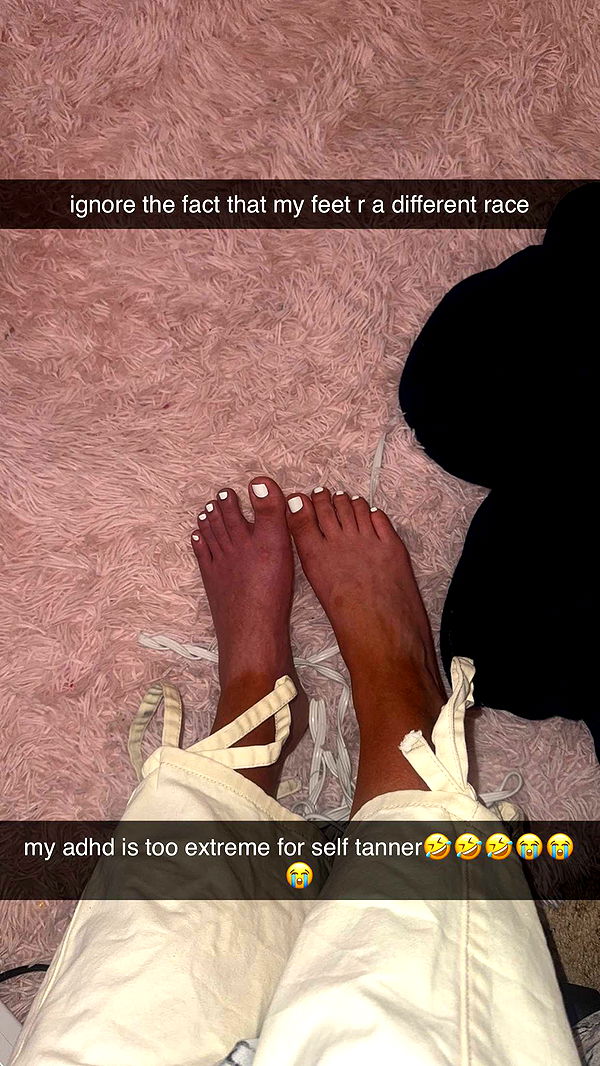 mbeeco image ~ Altpins