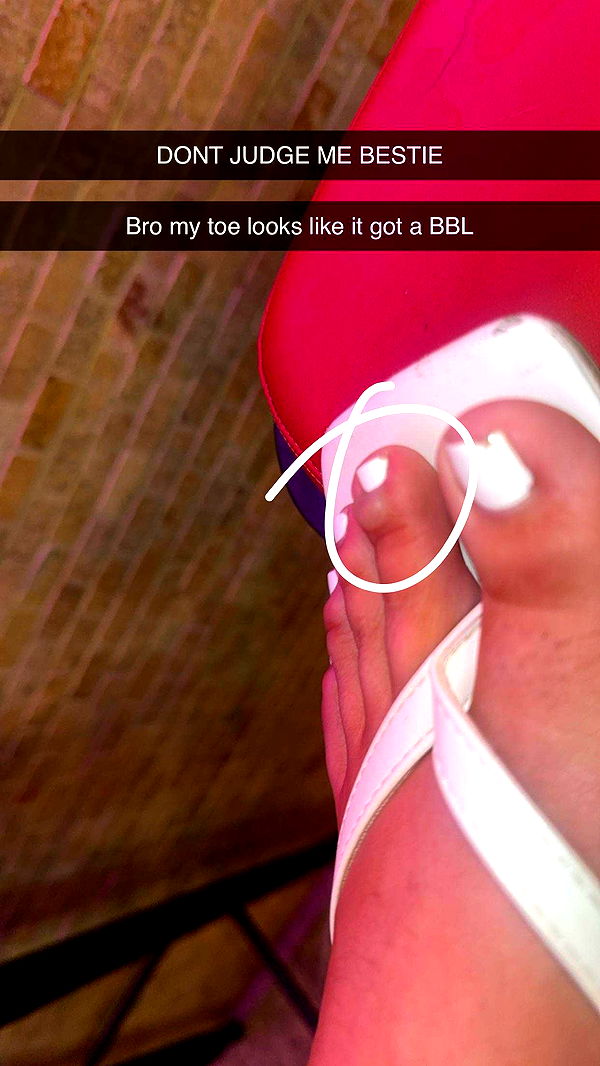 mbeeco image ~ Altpins