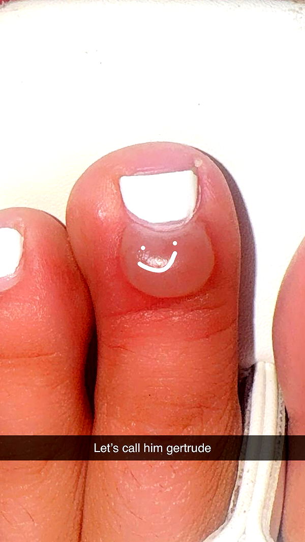 mbeeco image ~ Altpins