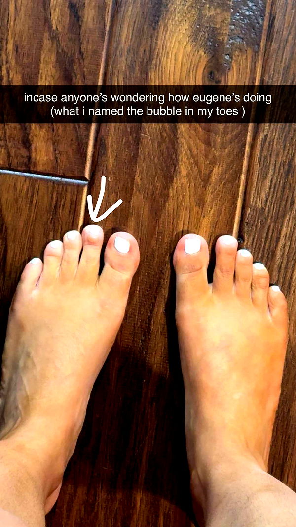 mbeeco image ~ Altpins