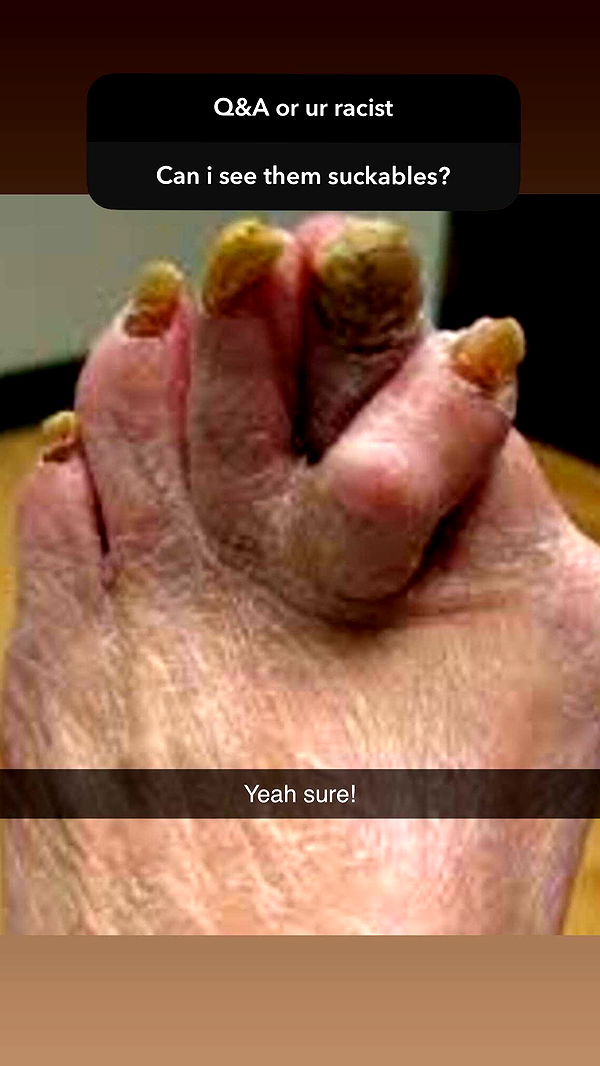 mbeeco image ~ Altpins