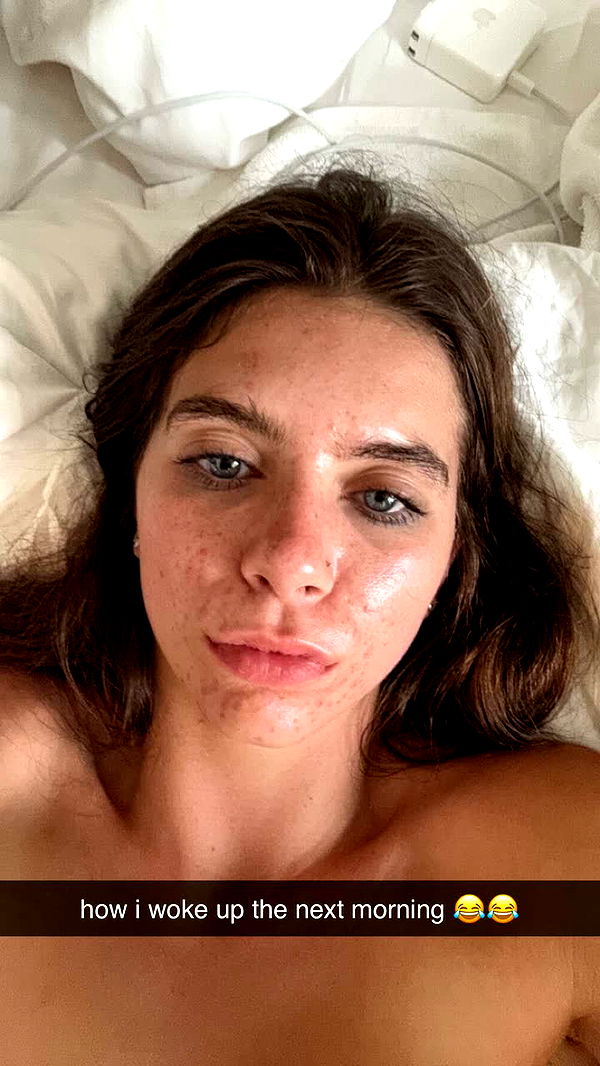 mckinley_1 image ~ Altpins