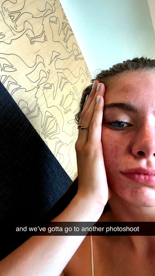 mckinley_1 image ~ Altpins