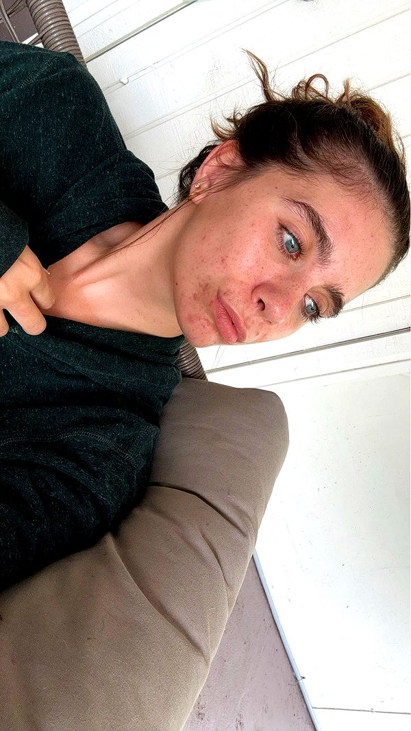 mckinley_1 image ~ Altpins