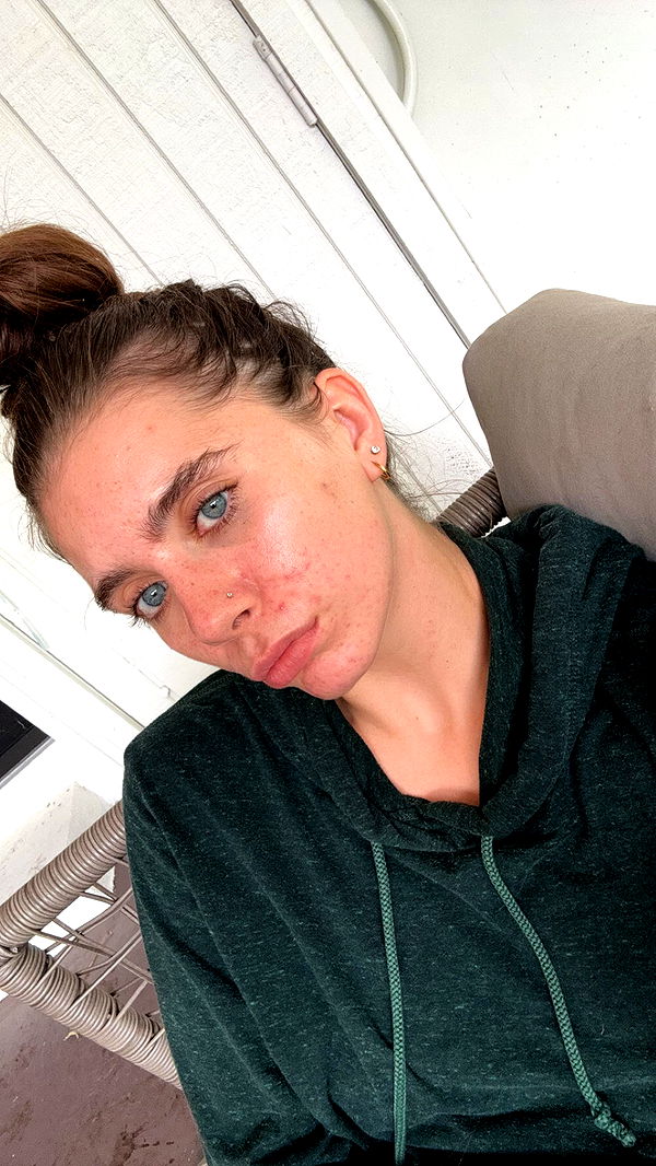 mckinley_1 image ~ Altpins