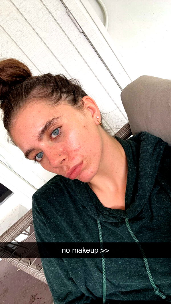 mckinley_1 image ~ Altpins