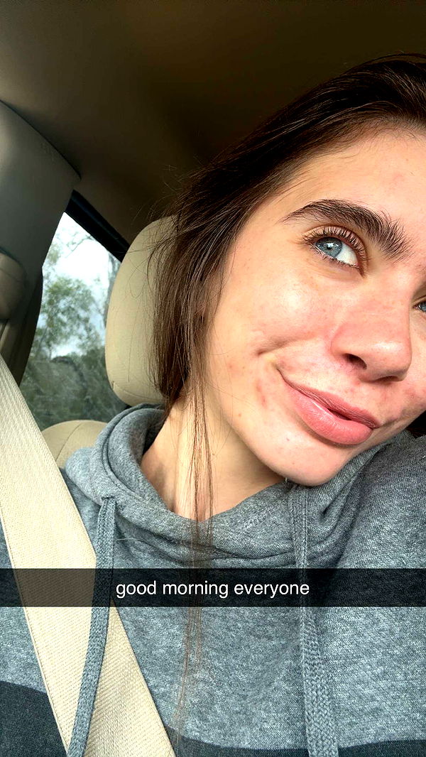 mckinley_1 image ~ Altpins