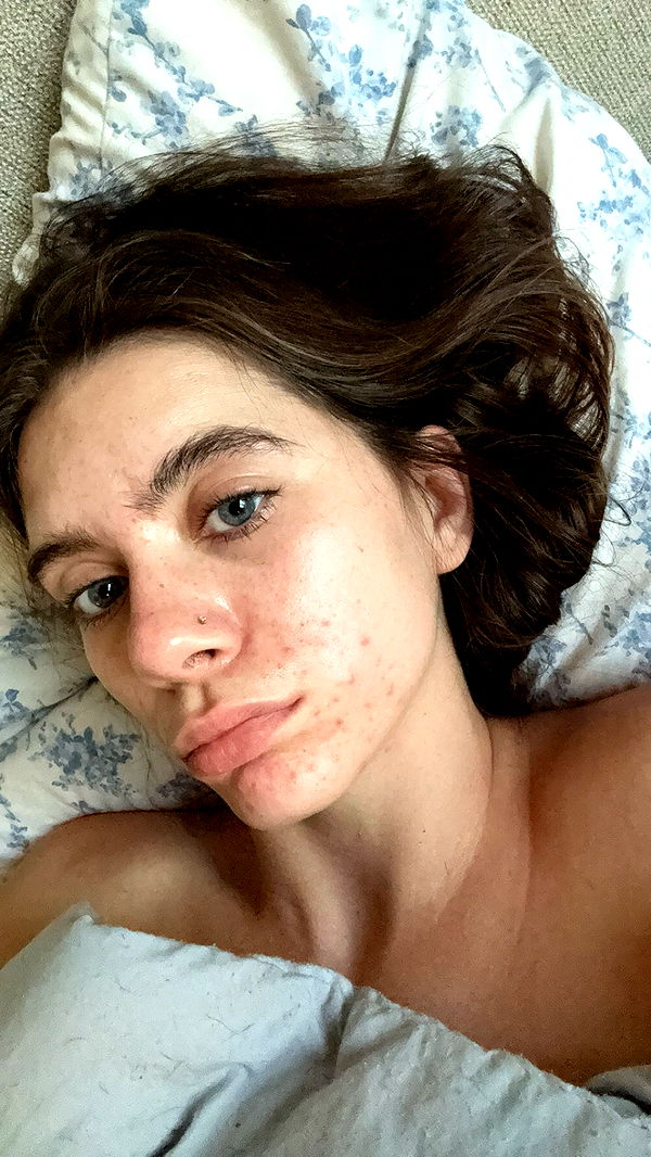 mckinley_1 image ~ Altpins