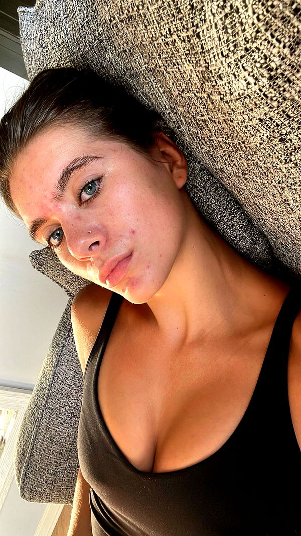 mckinley_1 image ~ Altpins