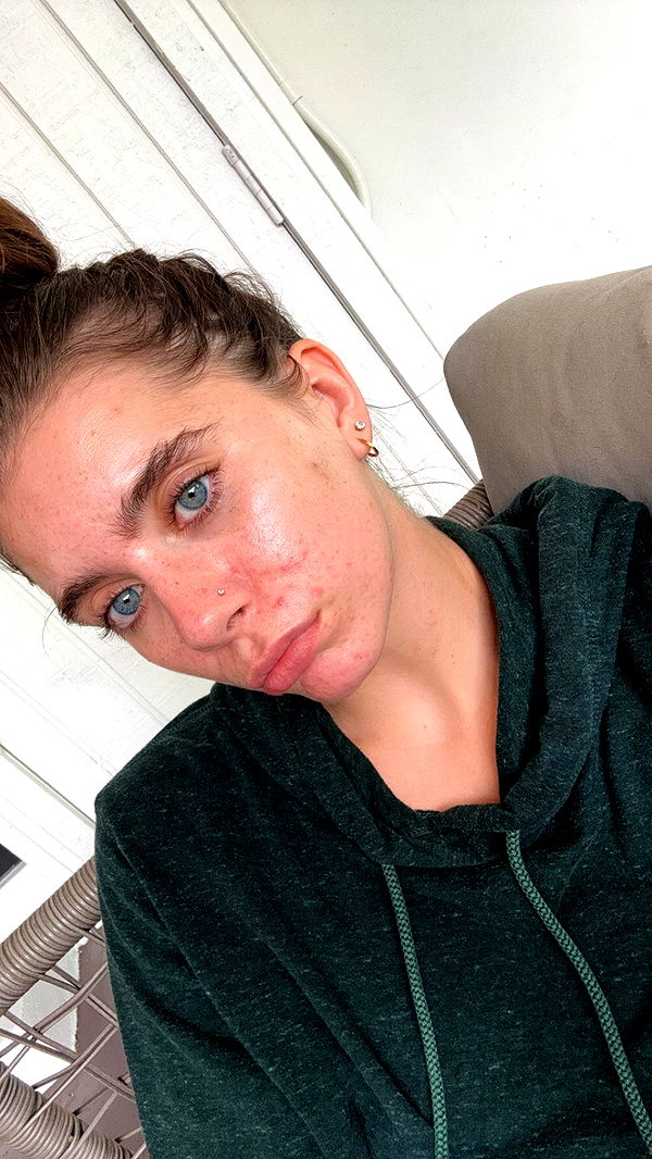 mckinley_1 image ~ Altpins