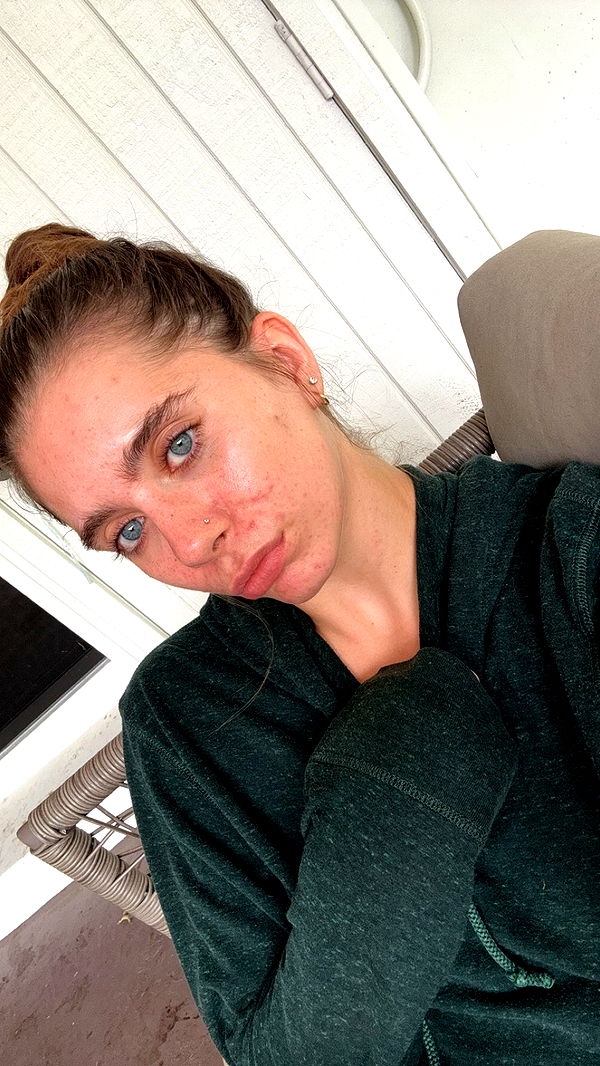 mckinley_1 image ~ Altpins