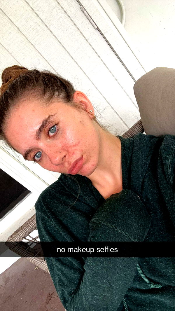 mckinley_1 image ~ Altpins