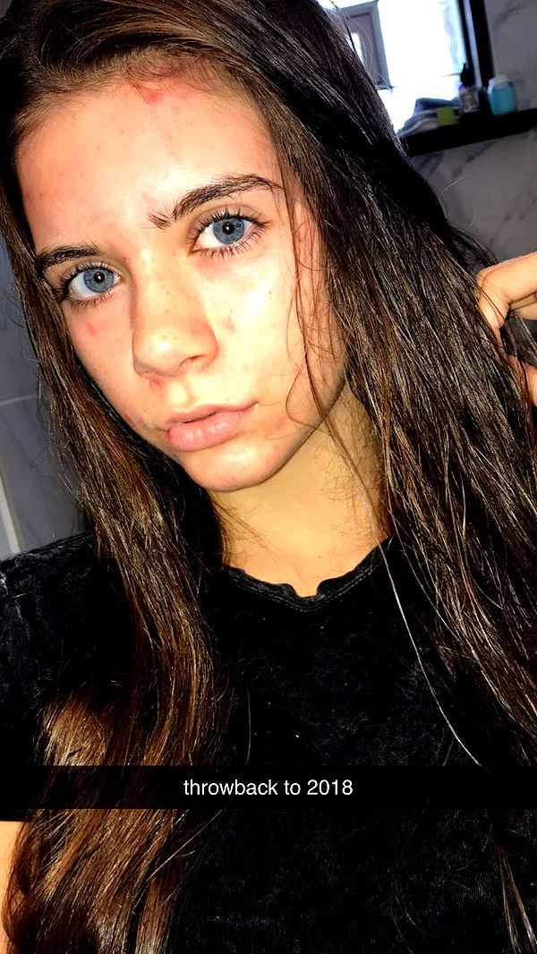 mckinley_1 image ~ Altpins