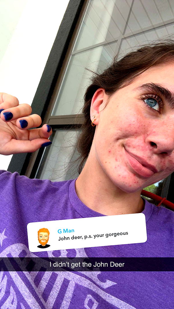 mckinley_1 image ~ Altpins