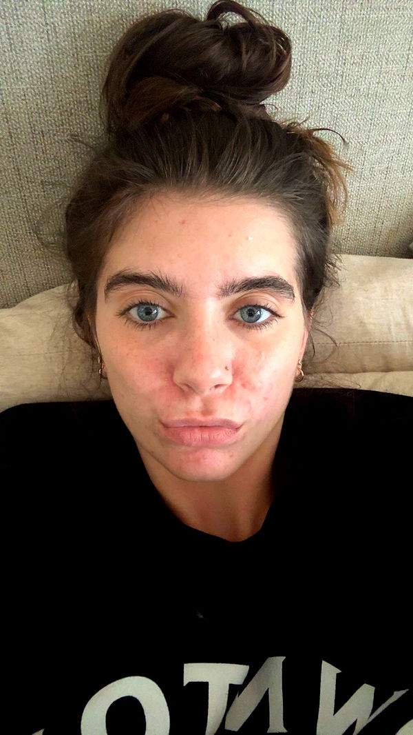 mckinley_1 image ~ Altpins