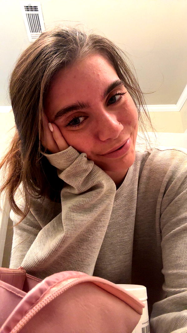 mckinley_1 image ~ Altpins