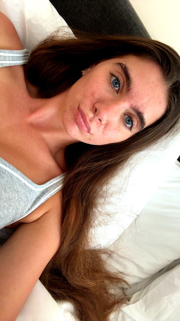 mckinley_1 image ~ Altpins