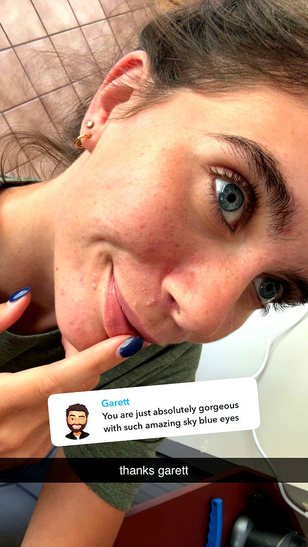 mckinley_1 image ~ Altpins