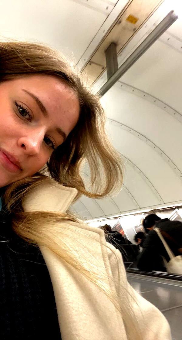 mira.0004 image ~ Altpins