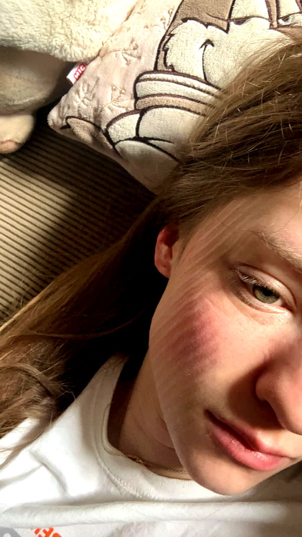 mira.0004 image ~ Altpins