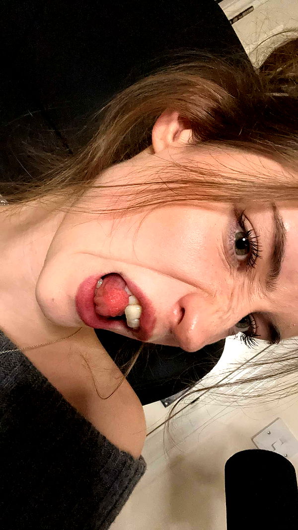 mira.0004 image ~ Altpins