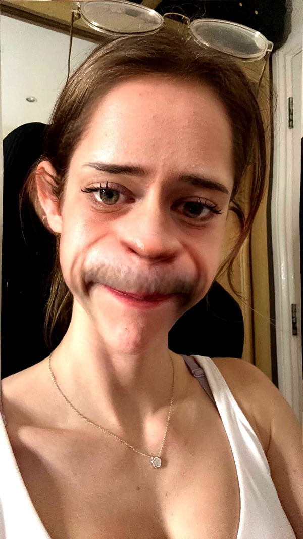 mira.0004 image ~ Altpins