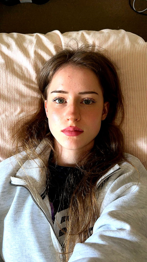 mira.0004 image ~ Altpins