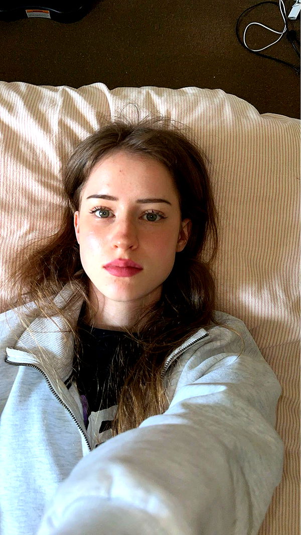 mira.0004 image ~ Altpins