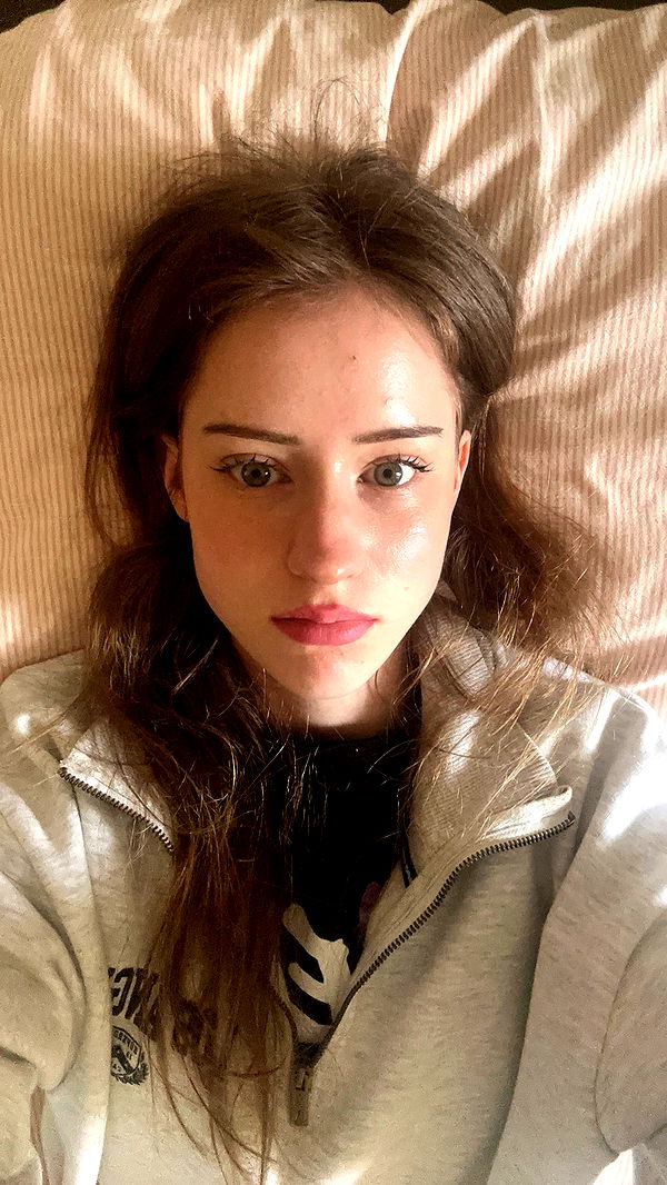 mira.0004 image ~ Altpins