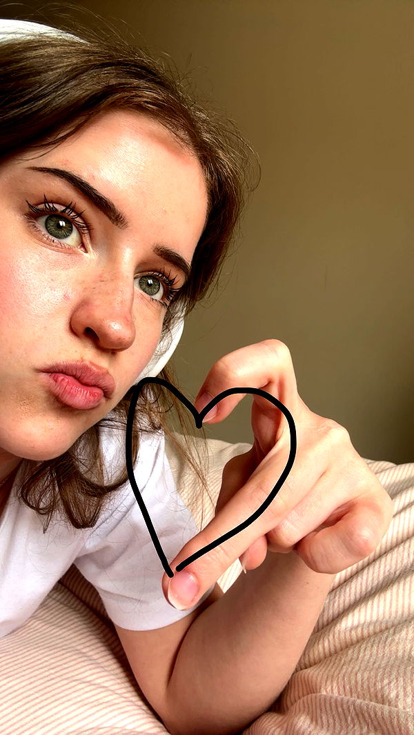 mira.0004 image ~ Altpins