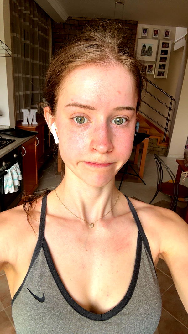 mira.0004 image ~ Altpins