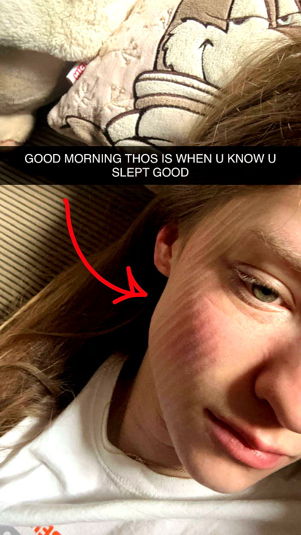 mira.0004 image ~ Altpins