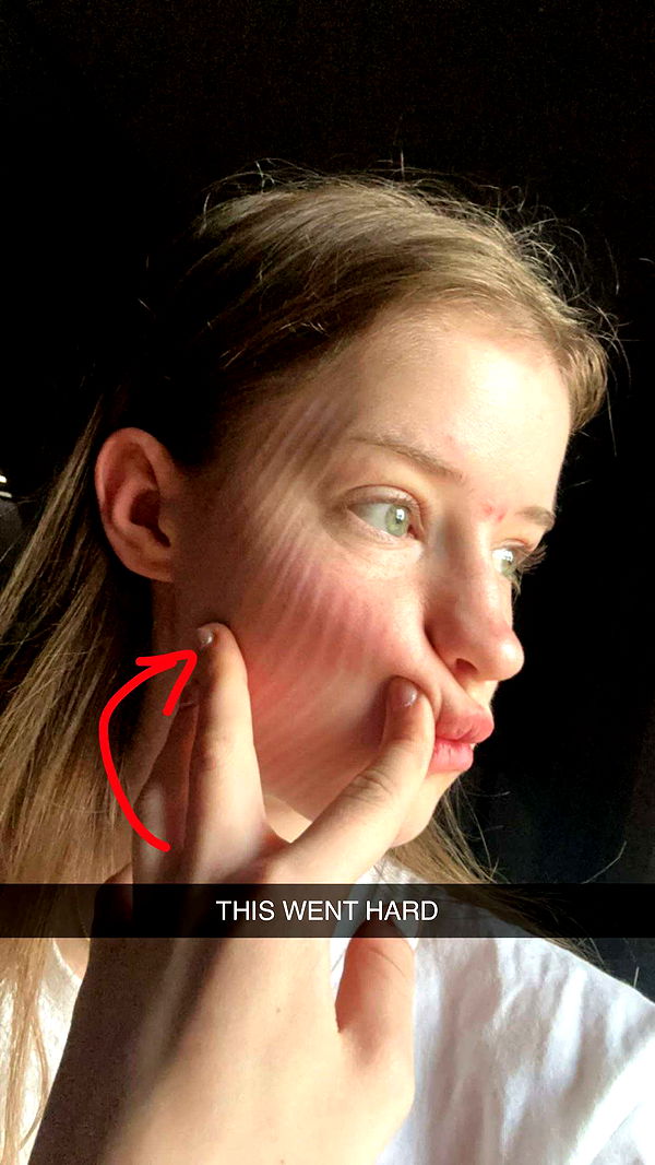 mira.0004 image ~ Altpins