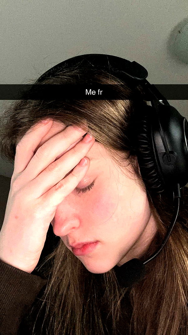 mira.0004 image ~ Altpins