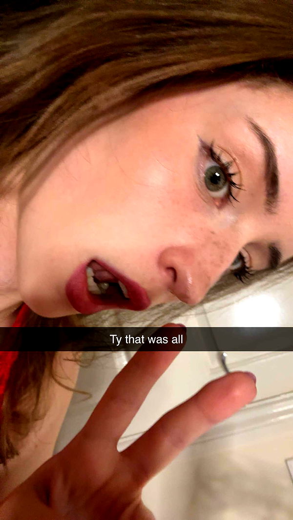 mira.0004 image ~ Altpins