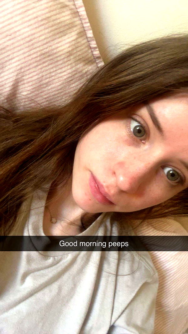 mira.0004 image ~ Altpins